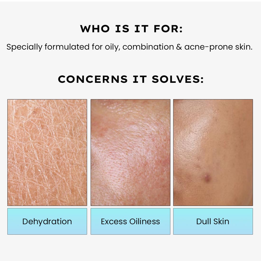Hyphen Cica Exosomes Oil-Free Moisturizer 50ml - Luxury Hydration for All Skin Types