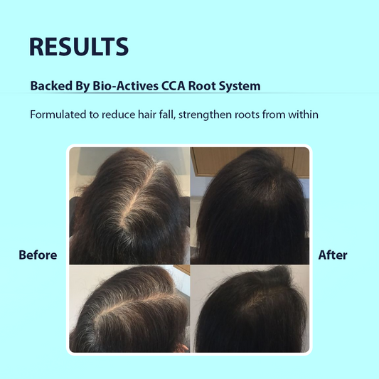 Dermistry Follicusan Hairgenyl & Caffeine Anti Hair Fall Control Serum Mask & Shampoo