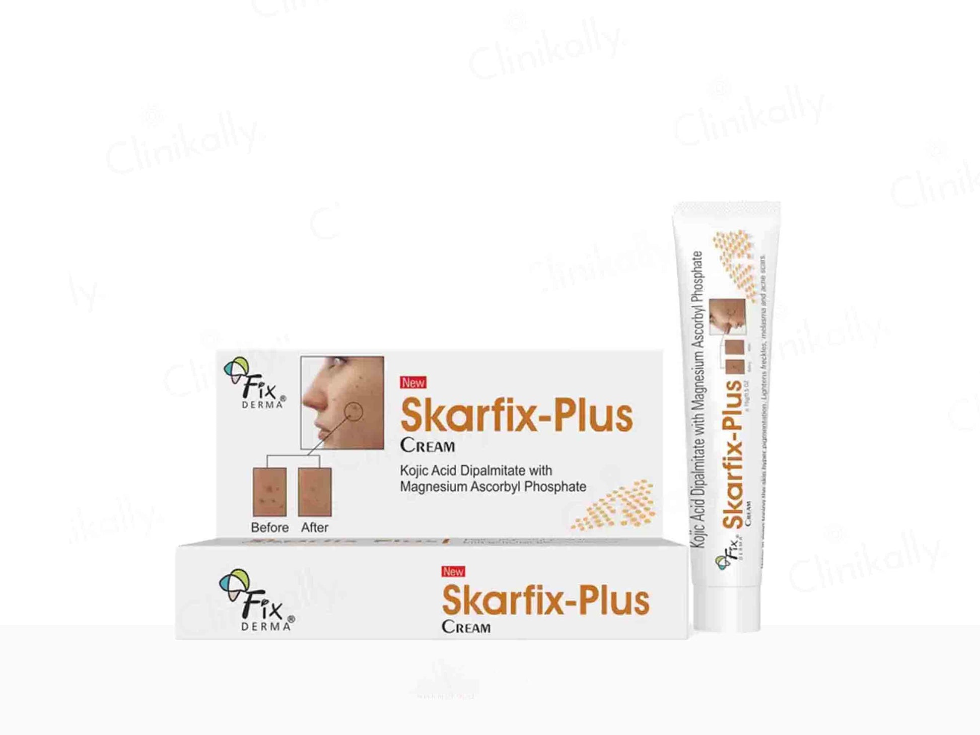 Skarfix-Plus Cream