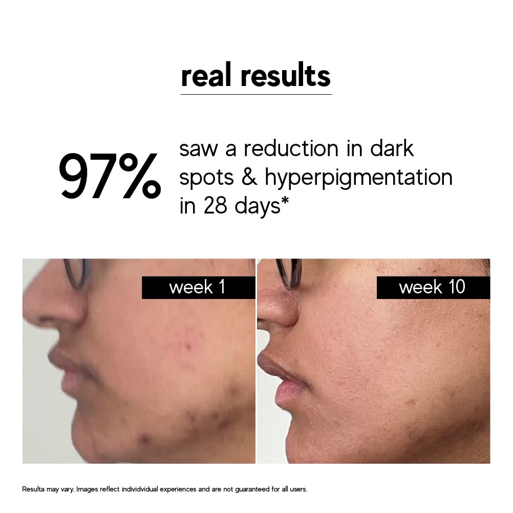 indē wild Vitamin C Serum 30ml for Radiant Skin with Turmeric & Niacinamide