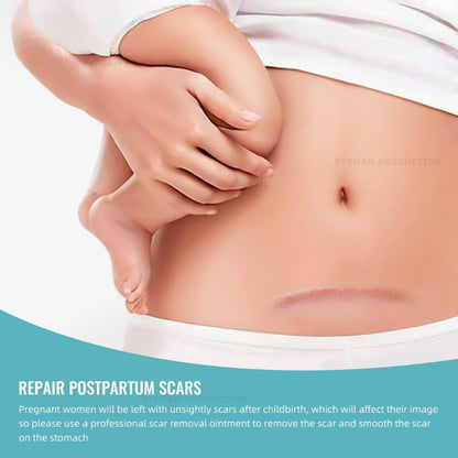 Scar Gel with Retinol for Face & Body Scars, Stretch Marks, 50g