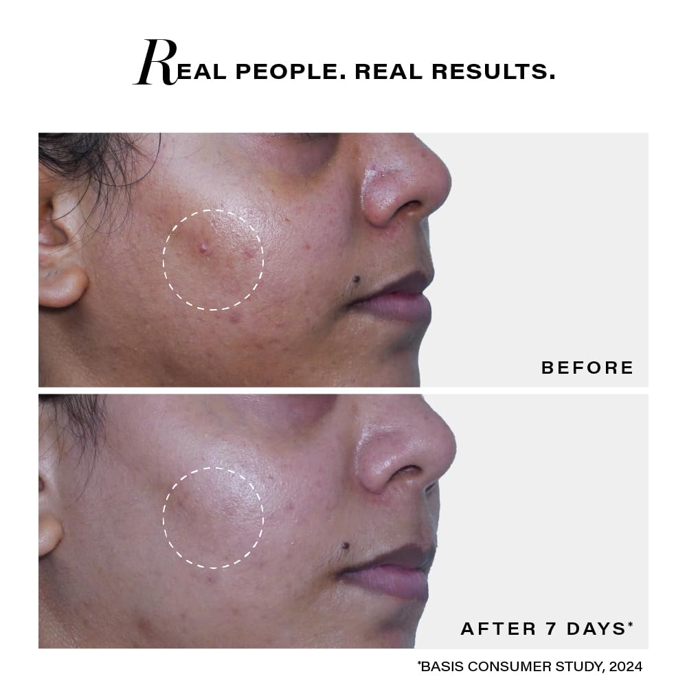Novology Luxury Acne Cleanser with Thymol+Terpineol, 150g
