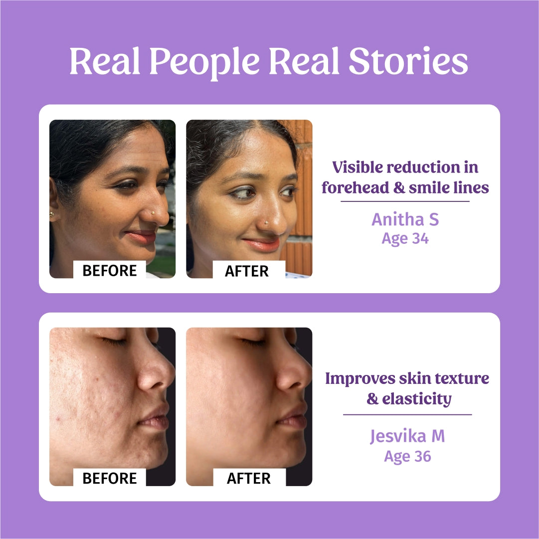 40ml Better Ageing Serum