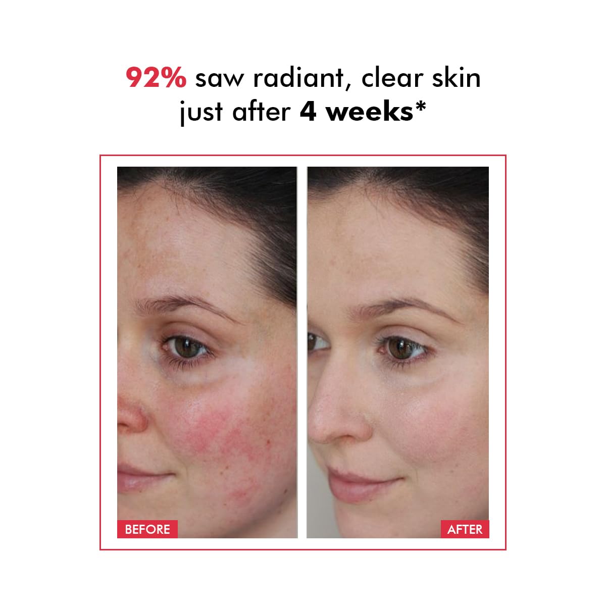 Conscious Chemist Advanced AHA BHA Peeling Solution 30ml Exfoliating Serum
