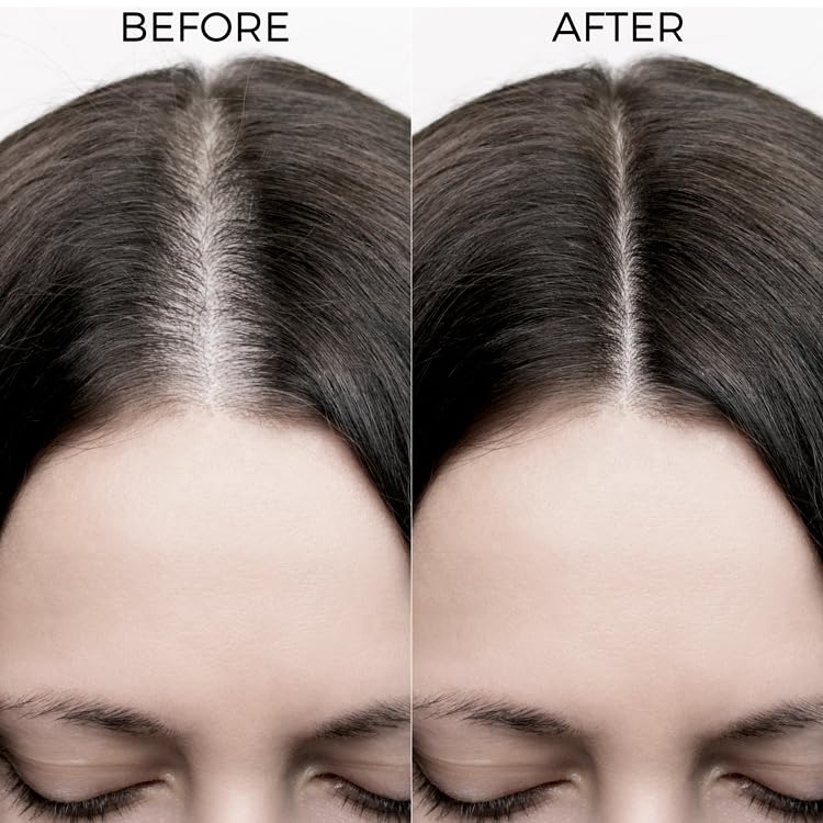 Brillare 20% Rosemary Oil Shots For Rapid Hair Growth