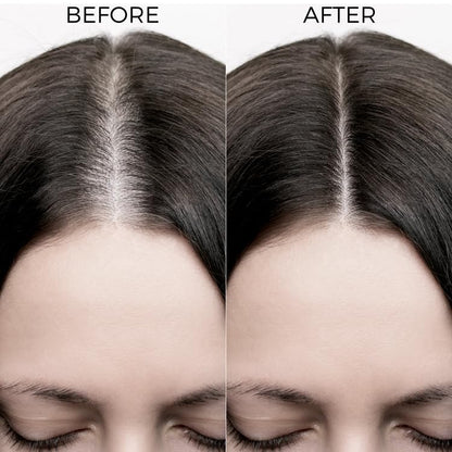 Brillare 20% Rosemary Oil Shots For Rapid Hair Growth