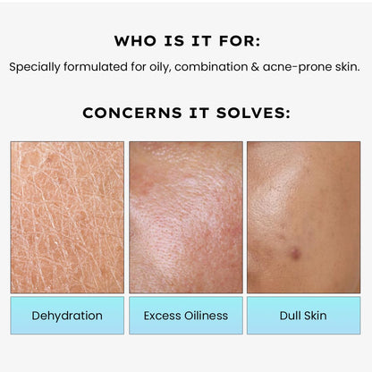 Hyphen Cica Exosomes Oil-Free Moisturizer 50ml - Luxury Hydration for All Skin Types