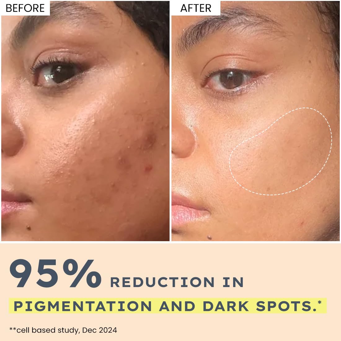 Hyphen Rice Water Brightening Serum Pads with Niacinamide, 50 Pads