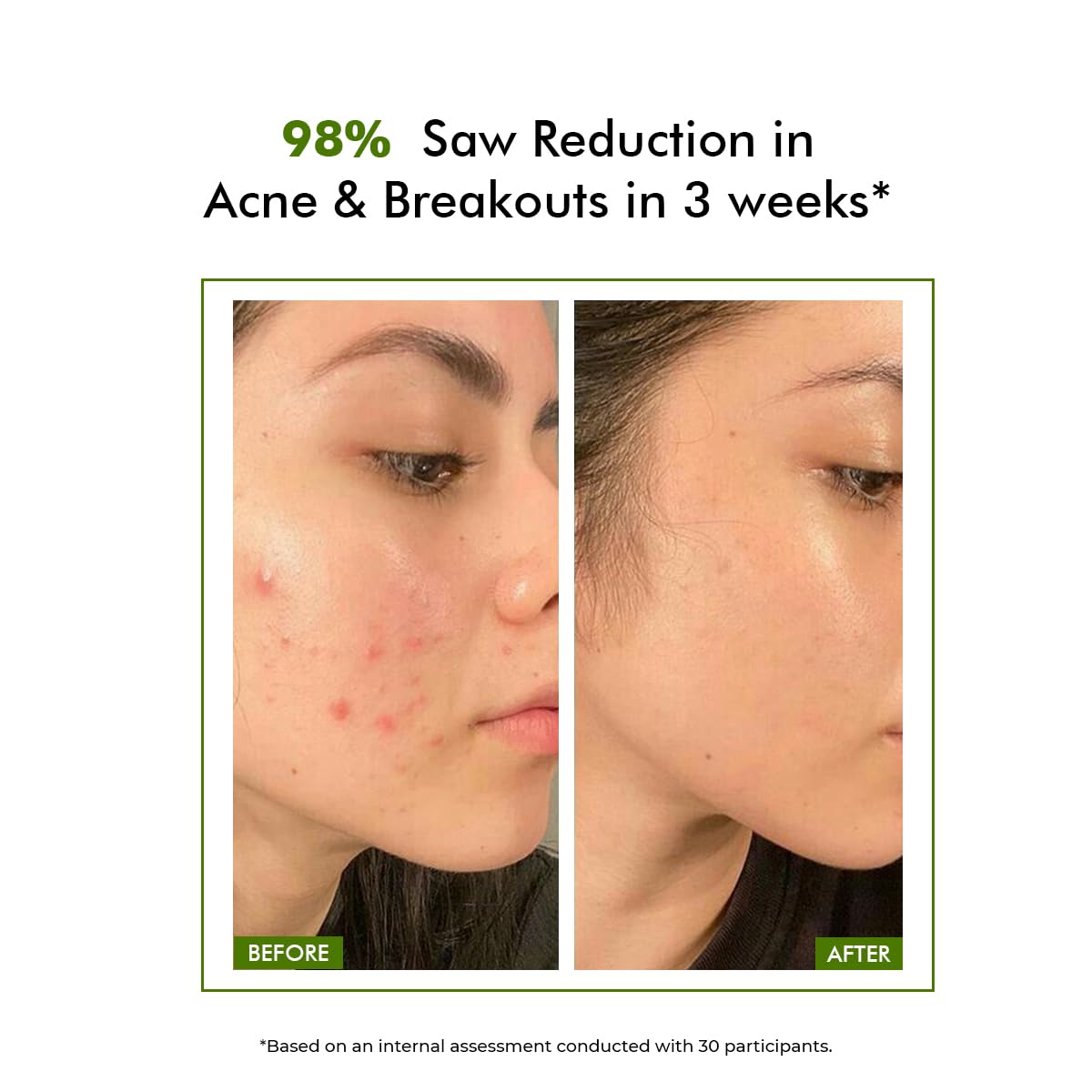 Conscious Chemist Salicylic Acid Serum 30ml for Acne & Pore Refinement