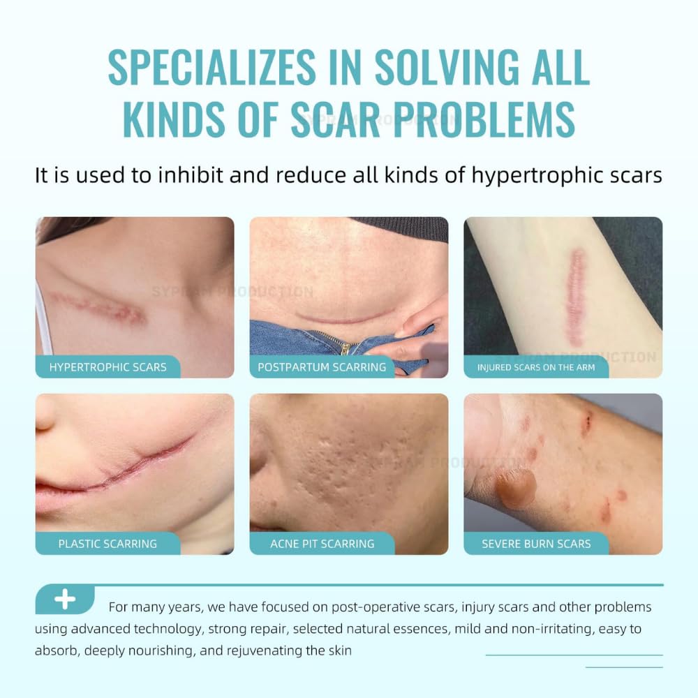 Scar Gel with Retinol for Face & Body Scars, Stretch Marks, 50g