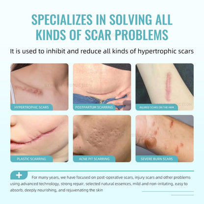 Scar Gel with Retinol for Face & Body Scars, Stretch Marks, 50g