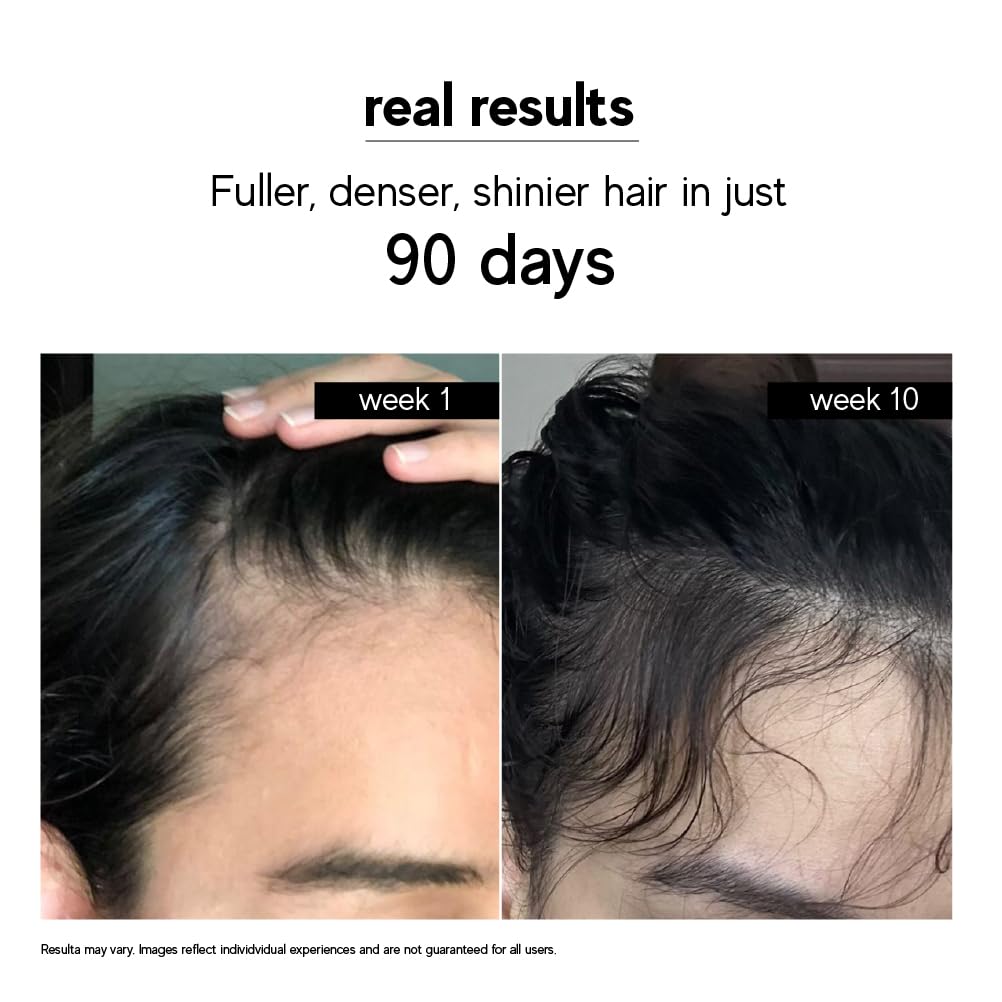 indē wild Moonlight Scalp Serum 50ml for Hair Growth & Density