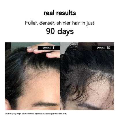 indē wild Moonlight Scalp Serum 50ml for Hair Growth & Density