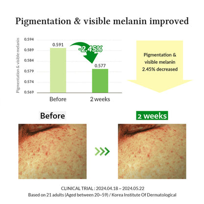Dr.Althea Gentle Vitamin C Serum: Low-Irritation Brightening Serum for Sensitive Skin