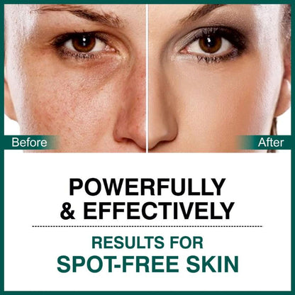 She Essentials Dark Spot Corrector Cream, Niacinamide & Vitamin E Oil