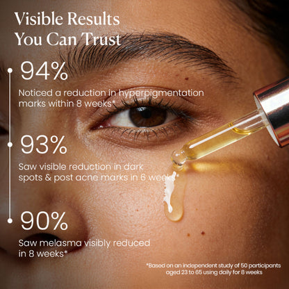 BiE - Beauty In Everything Zero Dark Spot Corrector & Anti-Pigmentation Serum