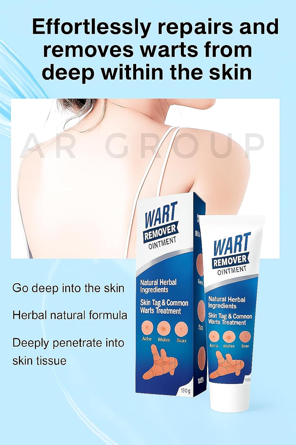 Wart & Skin Tag Remover Cream 100g for Face and Body