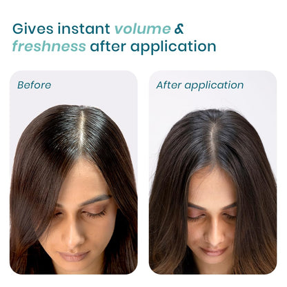 WishCare Luxury Dry Shampoo for Oily Hair with Niacinamide, 10g