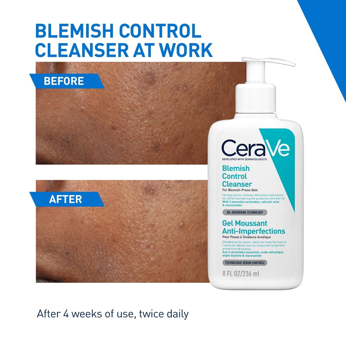CeraVe Acne Control Cleanser 2% Salicylic Acid Niacinamide 236ml