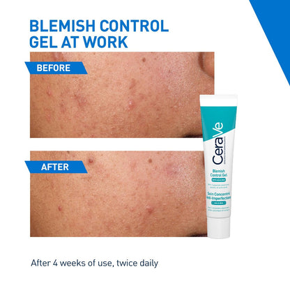 CeraVe Blemish Control Gel 2% Salicylic Acid, 40ml Acne Treatment
