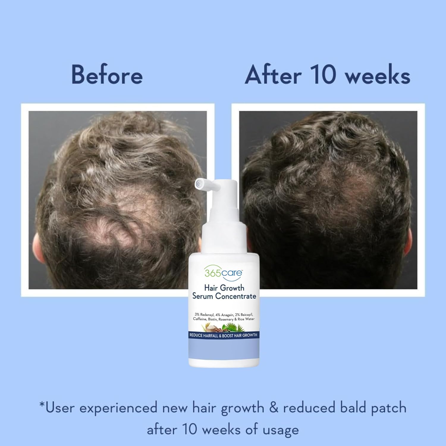 Luxurious Hair Growth Serum 50ml with Redensyl & Rice Water