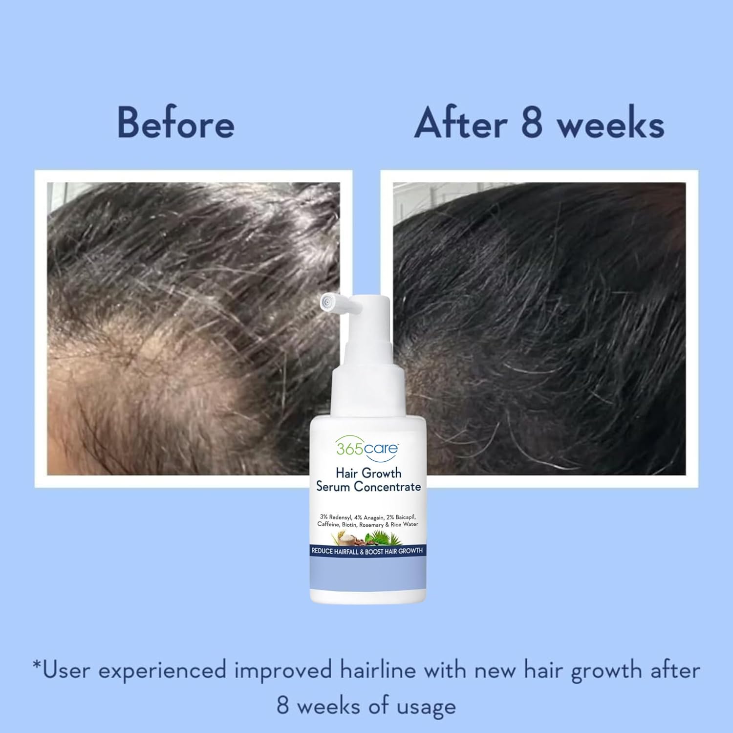 Luxurious Hair Growth Serum 50ml with Redensyl & Rice Water