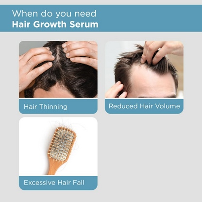 The Man Company Hair Growth Serum For Man
