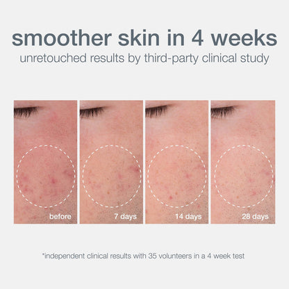 Dermalogica Daily Microfoliant Face Scrub