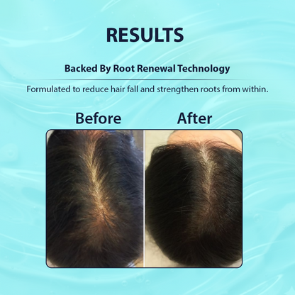 Dermistry Follicusan Hairgenyl & Caffeine Anti Hair Fall Control Serum & Shampoo