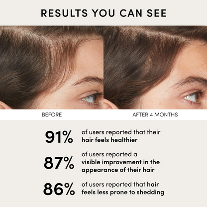 Ouai Scalp Serum
