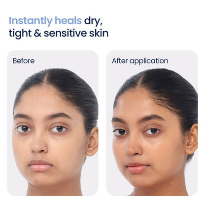 Wishcare 3:1:1 Barrier Bounce Moisturizer with Non-Comedogenic
