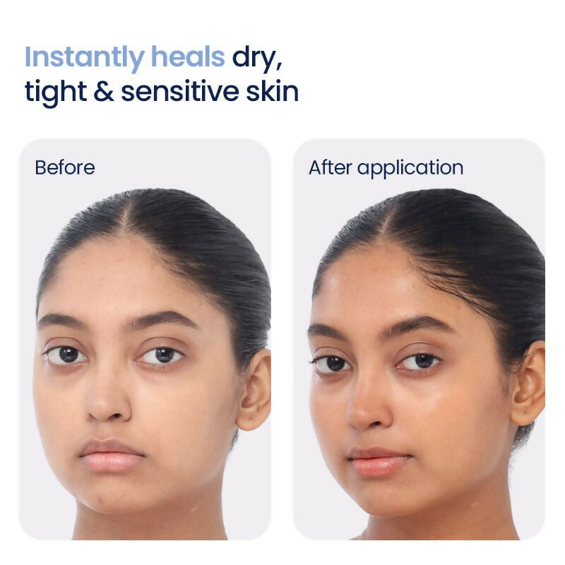 Wishcare 3:1:1 Barrier Bounce Moisturizer with Non-Comedogenic