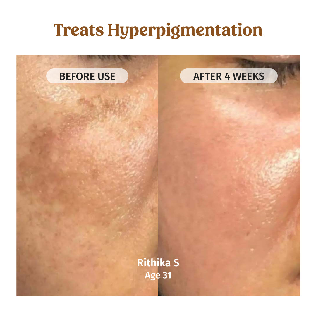 Milk Drops Brightening Serum