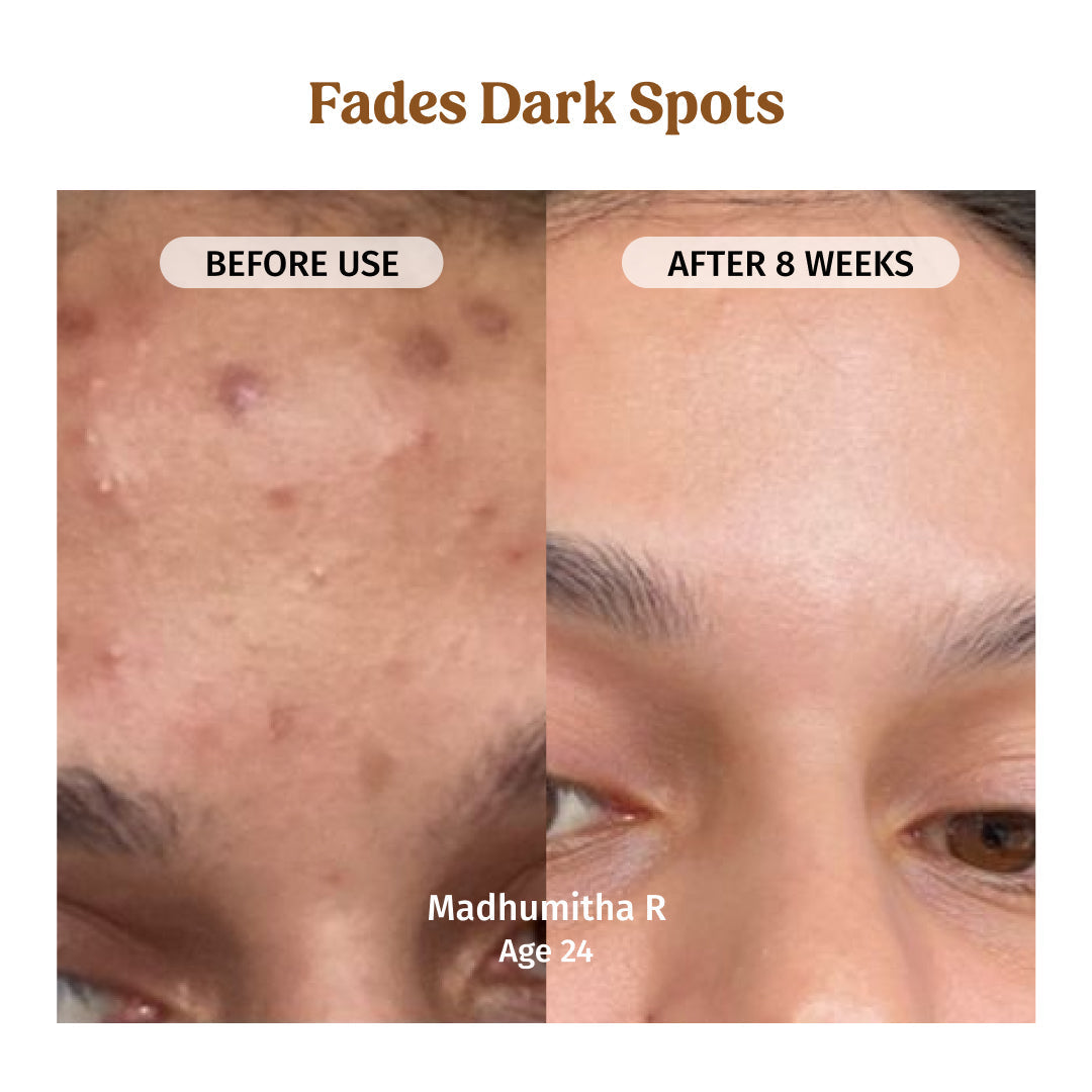 Milk Drops Brightening Serum