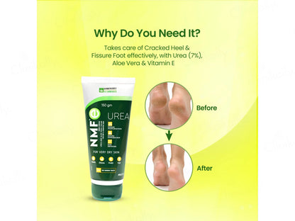 NMFe Urea and Aloe Vera Cream For Very Dry Skin