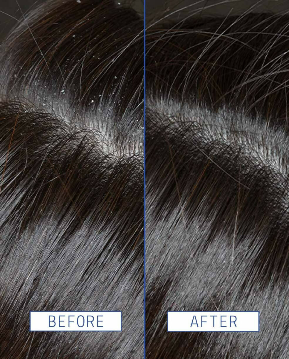 Aavrani Scalp Rescue Serum