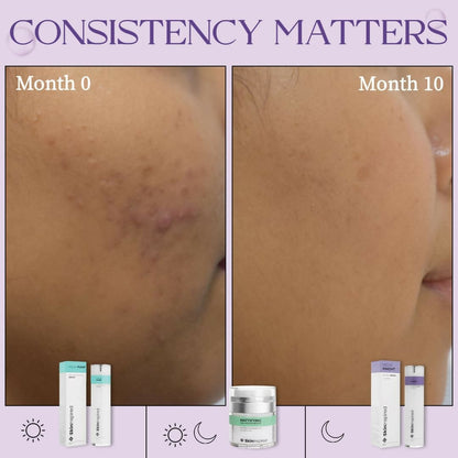 SkinInspired Retinol Face Serum (2% vitAlease)