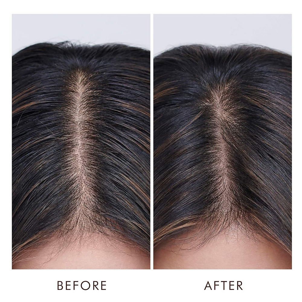 Moroccanoil Oily Scalp Treatment For Oily, Imbalanced Scalps