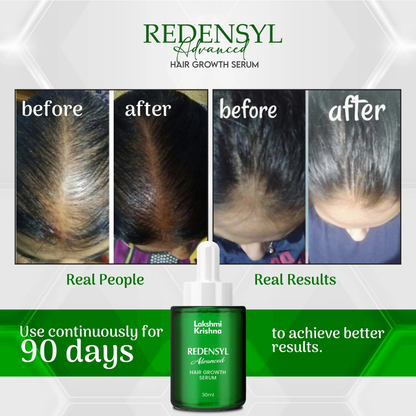 Lakshmi Krishna Naturals Redensyl Advanced Hair Growth Serum