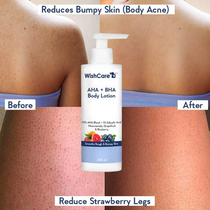 WishCare 10% AHA + 1% BHA Body Lotion for Smooths Rough & Bumpy Skin