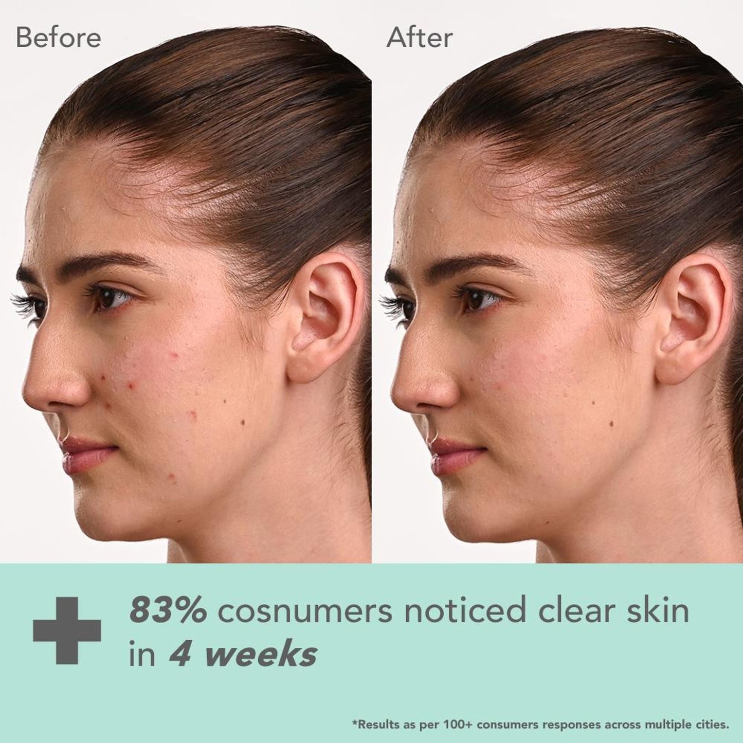 Lotus DermaBotanics Kojic Acid + Multi Berry Ampoule Crème, pH5.5, For Sensitive Skin
