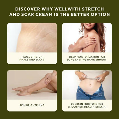 Wellwith Stretch & Scar Cream with Seabuckthorn Oil, Licorice & Hyaluronic Acid