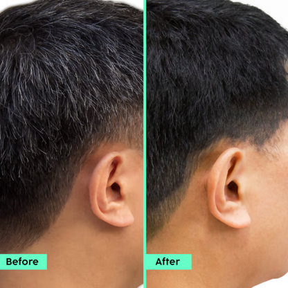 PLIX The Plant Fix Rosemary Anti Hairfall Shampoo & Hair Mask