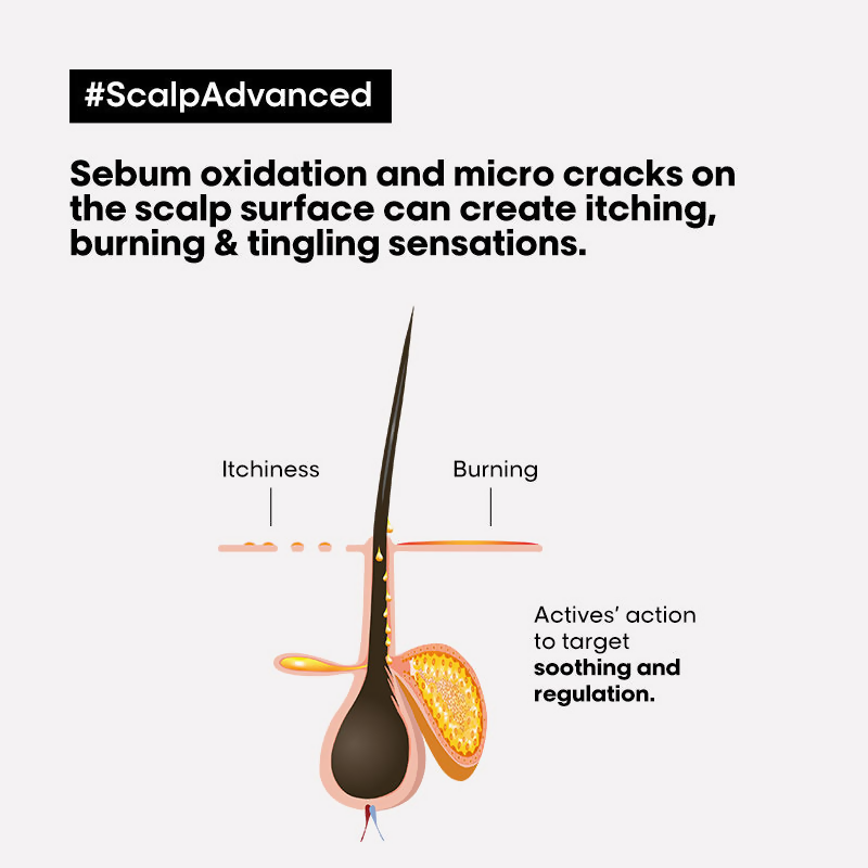 L'Oreal Professionnel Scalp Advanced Anti-Dandruff Dermo-Clarifier Shampoo + Metal Dx Hair Mask