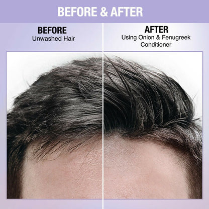 Nykaa Naturals Anti-Hair Fall -Free Conditioner With Onion & Fenugreek - Limited Time Offer