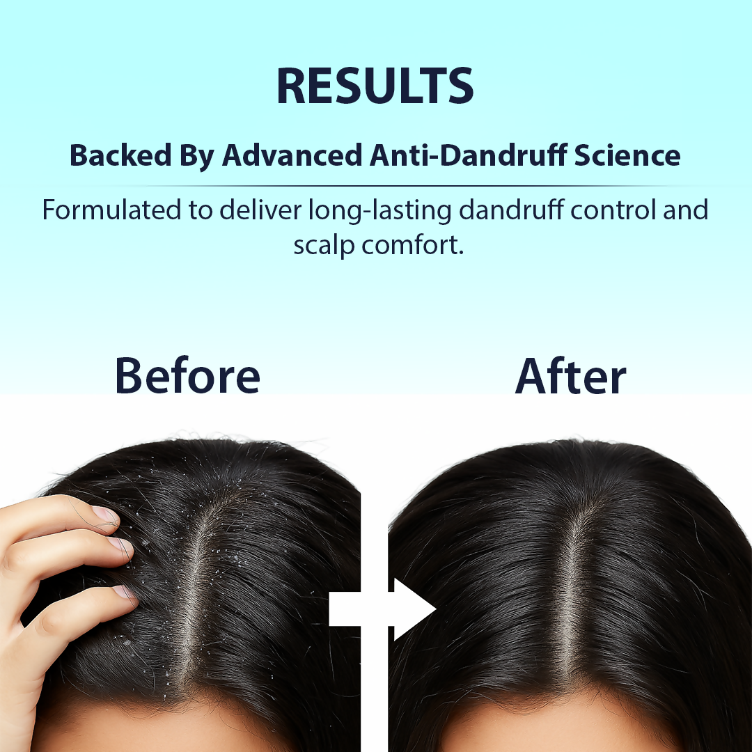 Dermistry Anti-Dandruff Control Shampoo & Mask
