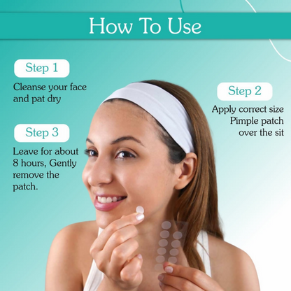 Bake 2% Salicylic Acid Pimple Patches (144 Dots)