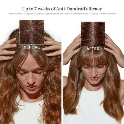 Kerastase Symbiose Bain Pureté Anti-Dandruff Shampoo