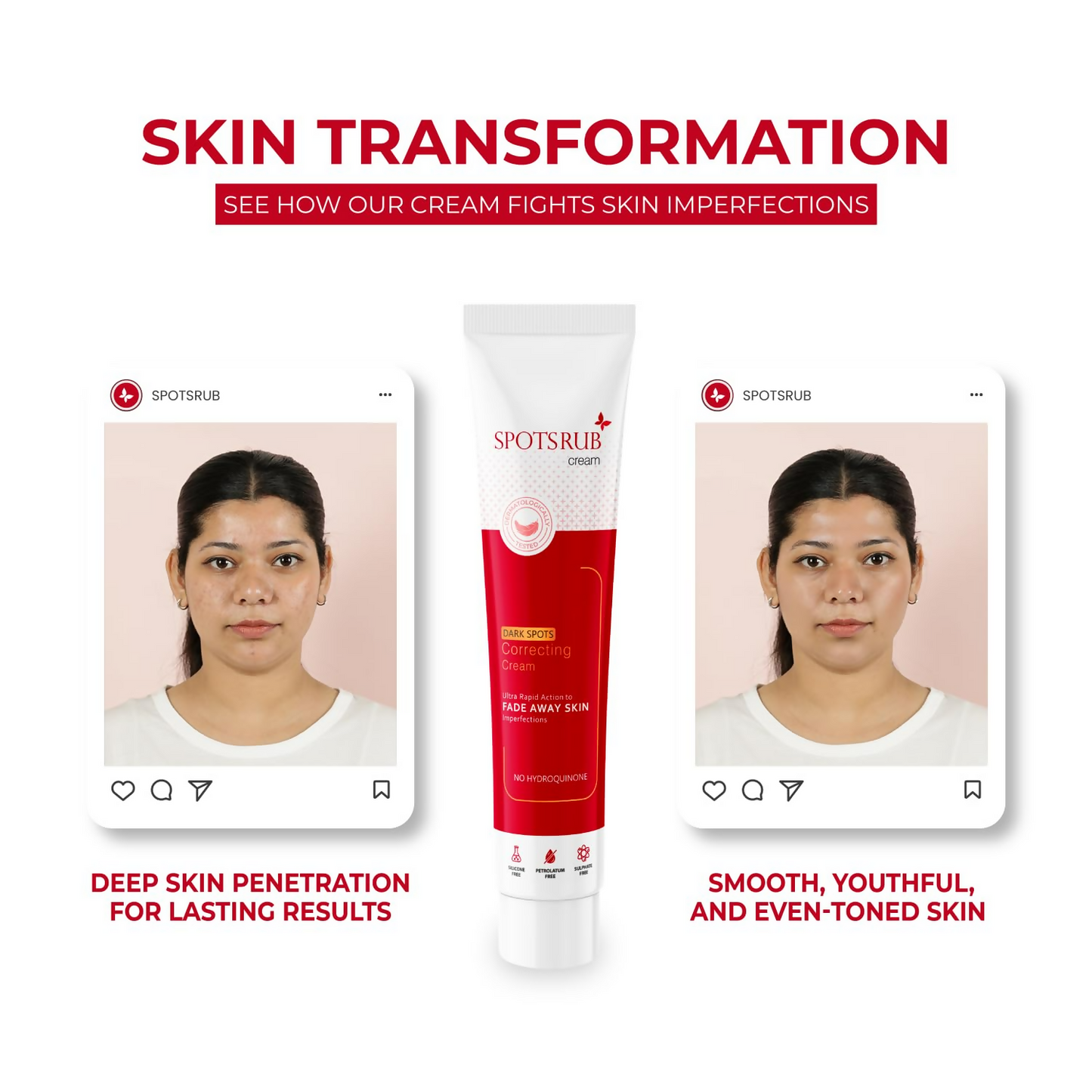 Leeford Spotsrub Face Cream For Women